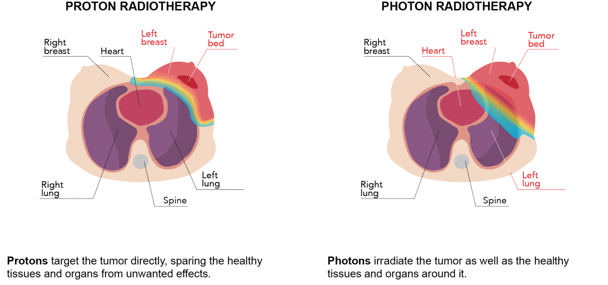 breast-schema.png (443 KB)