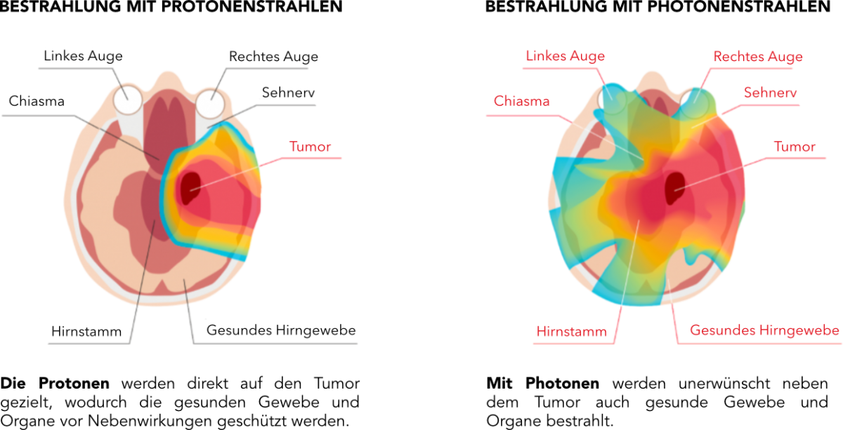 cns-protonvsphoton-de.png (292 KB)