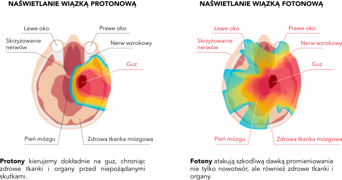 cns-protonvsphoton-pl.png (295 KB)