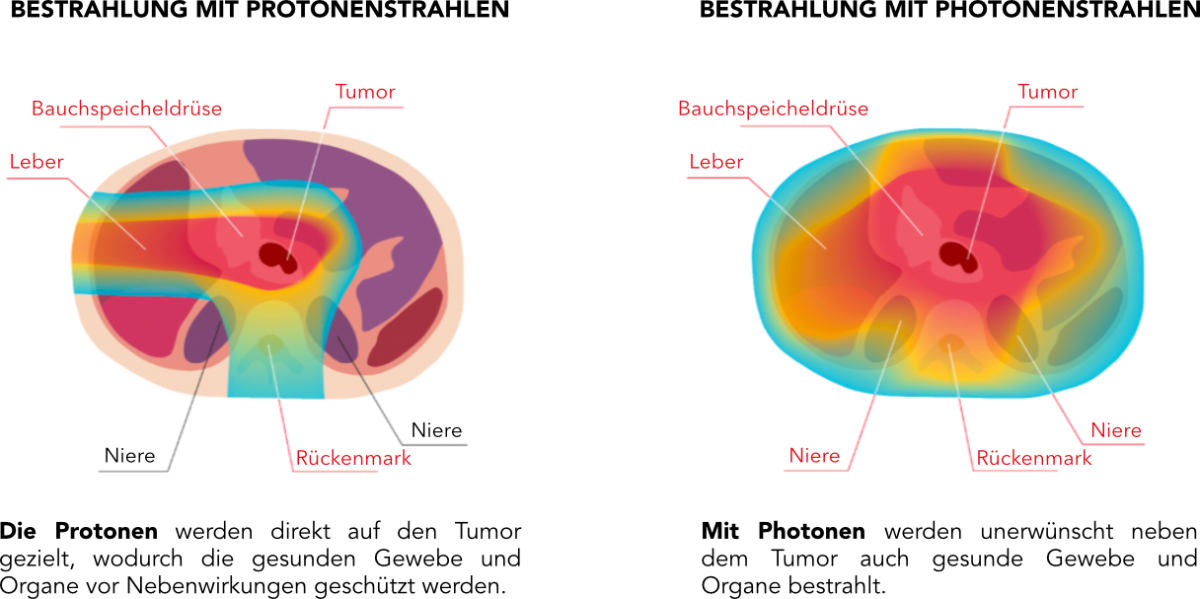 git-protonvsphoton-de.png (305 KB)