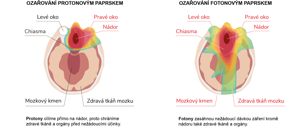 hlavaakrk-150x.png (309 KB)
