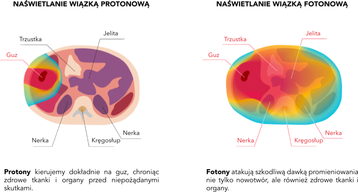 liver-protonvsphoton-pl.png (293 KB)