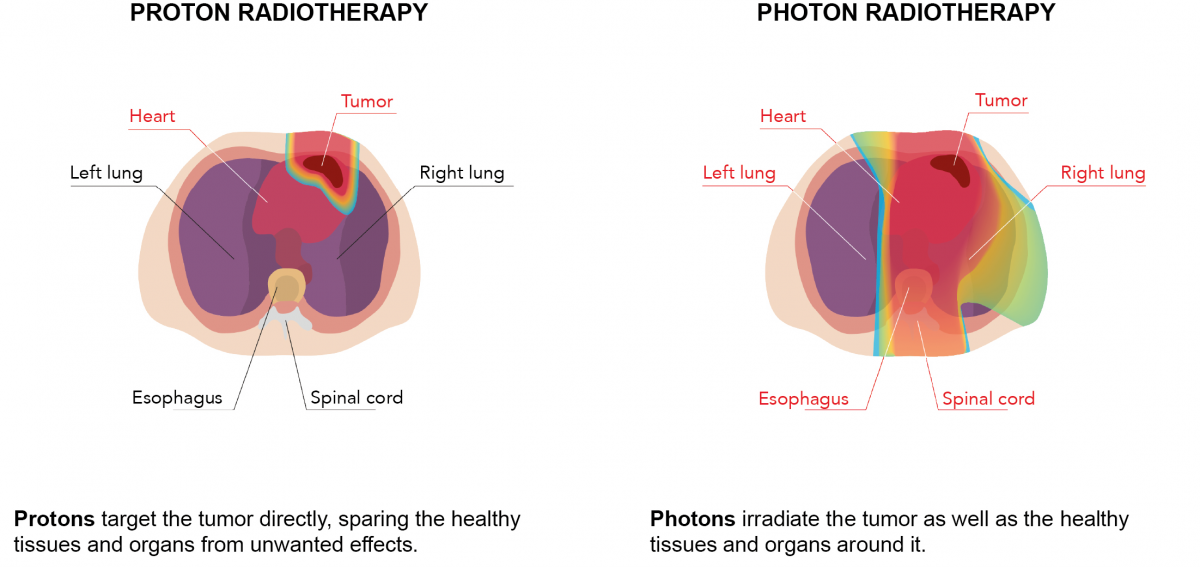 lymphoma.png (406 KB)