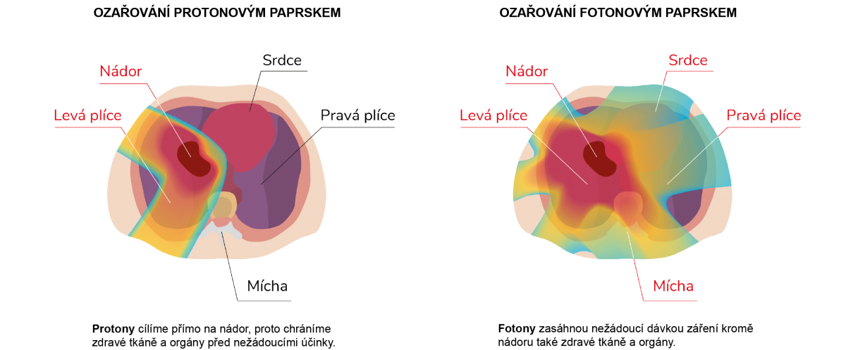 plice-150x.png (386 KB)