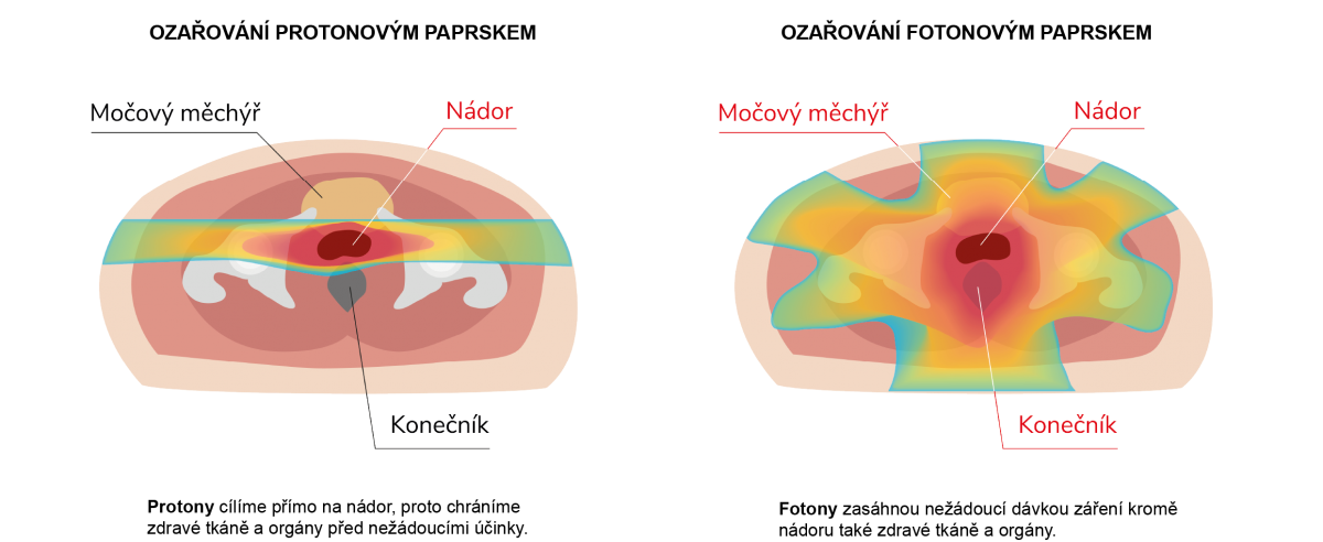 prostata-150x.png (390 KB)